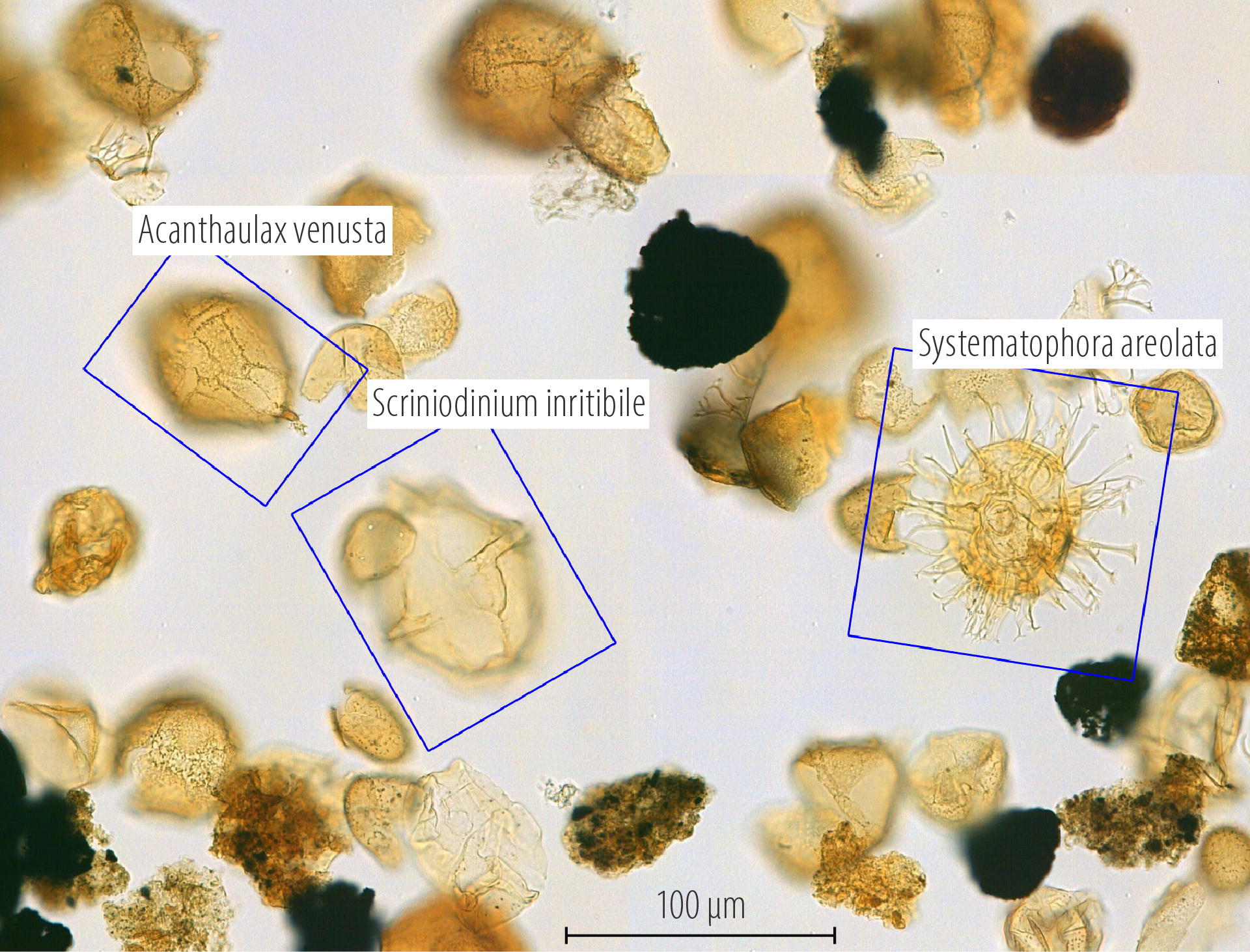 Figur 5.5 Mikrofossiler. Palynologisk preparat av pollen og sporer.